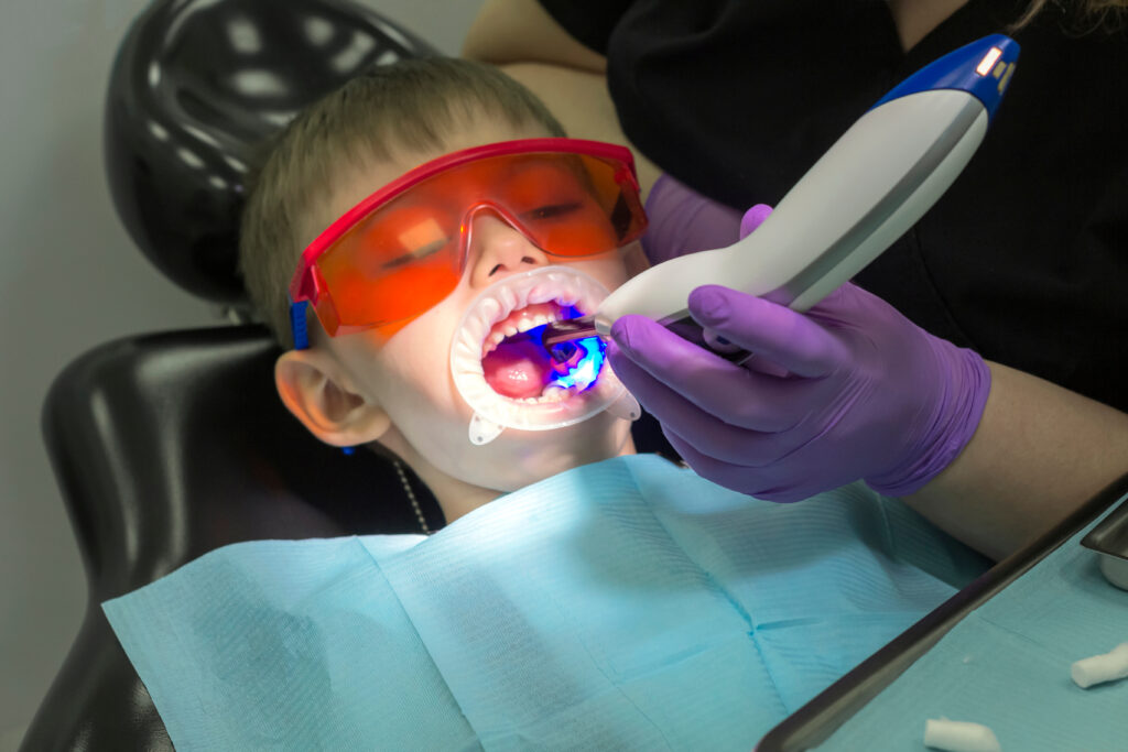 Pediatric Laser Dentistry Seattle