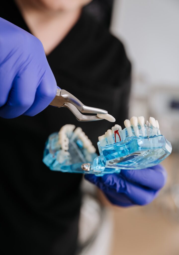 Tooth Extractions for Kids Renton